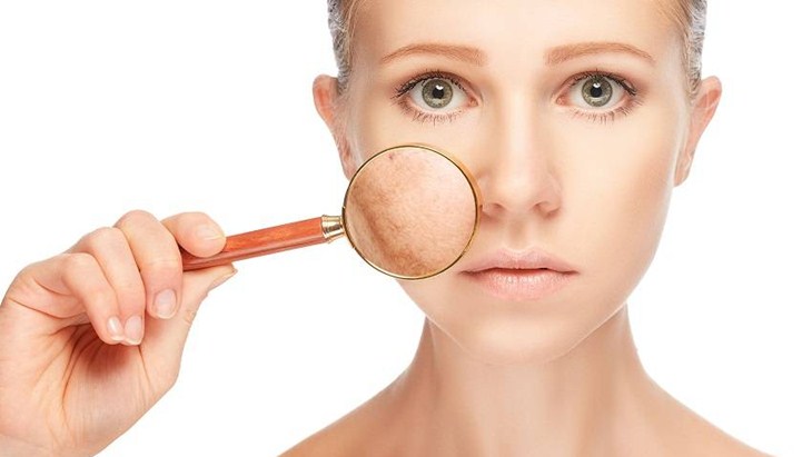 4 Cara Mengatasi Kulit Kering Agar Kembali Segar dan Sehat