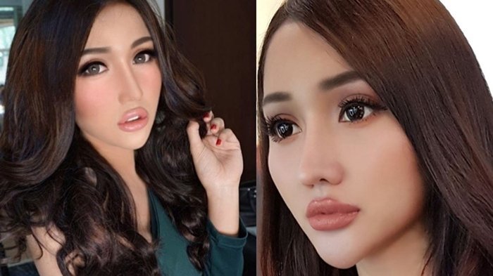 Lucinta Luna Memutuskan Lakukan Operasi Ganti Kelamin Pada 2016
