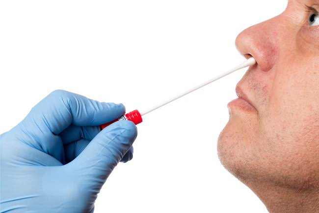 Banyak Dikritik, Pemerintah Turunkan Tarif Tes PCR dan Antigen