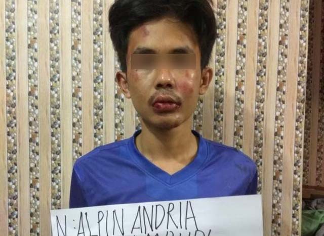 Direktur RSJ Lampung: Tak Ditemukan Rekam Medis Penusuk Syeh Ali Jaber