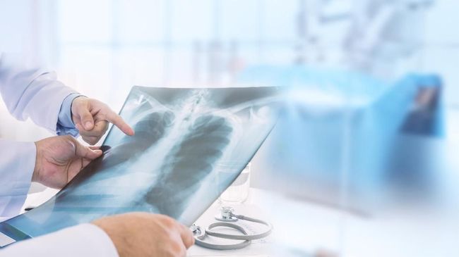 Riau masih bebas penyakit Pneumonia