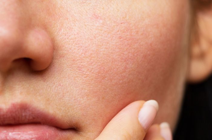 4 Skincare Berikut Ampuh Kecilkan Pori-pori Besar di Wajah