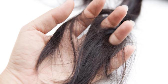 5 Hal Sebabkan Rambut Rontok