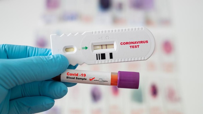 Satgas: Rapid Test Antigen Bisa Digunakan di Indonesia