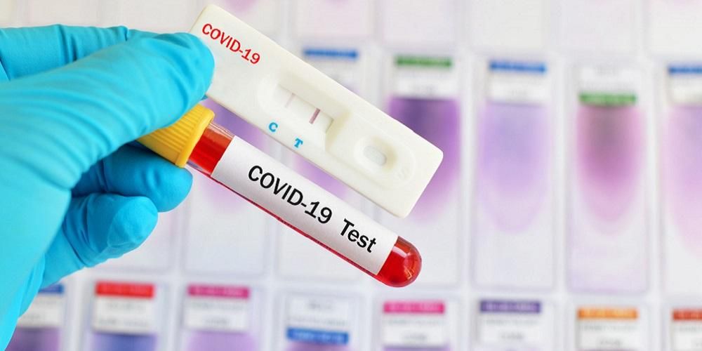 Dukung Upaya Memutus Mata Rantai Covod-19, Pekanbaru Butuh 2.000 Alat Rapid Test