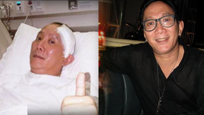Aktor Robby Tumewu Meninggal Dunia Setelah Alami Stroke